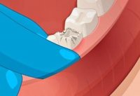 Smile Care: Tooth Repair Sim