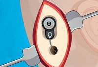 Ear Wellness: Medical Puzzle Adventure