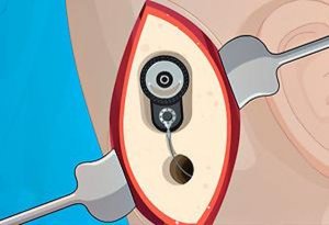 Ear Care: Medical Simulation Game